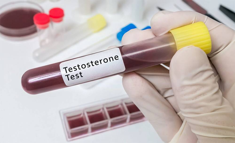 Χαμηλή Τεστοστερόνη